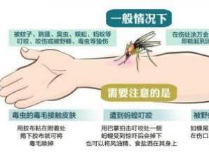 被毒蚊子咬了怎么办？蚊子咬了怎么消肿止痒